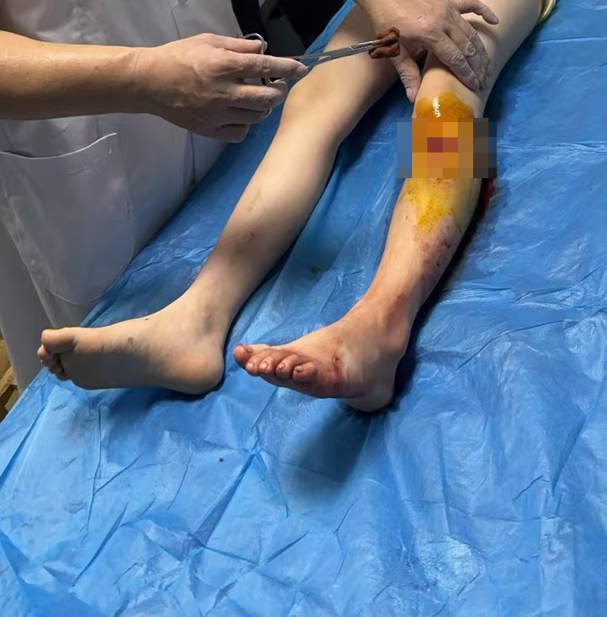 多名孩子在景区水池被瓷砖割伤，衡阳南岳文旅局：正沟通处理