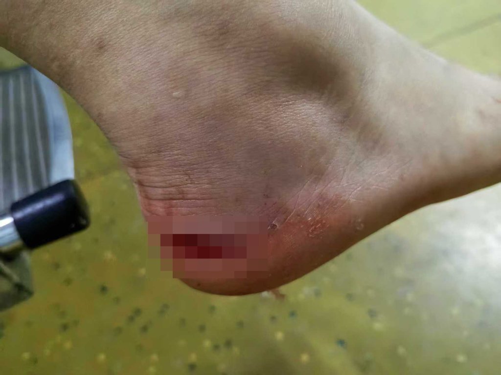 多名孩子在景区水池被瓷砖割伤,衡阳南岳文旅局:正沟通处理